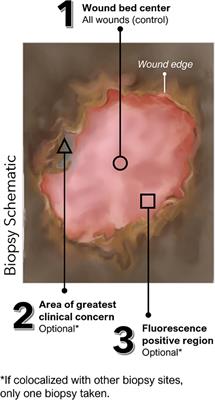 Use of fluorescence imaging to optimize location of tissue sampling in hard-to-heal wounds